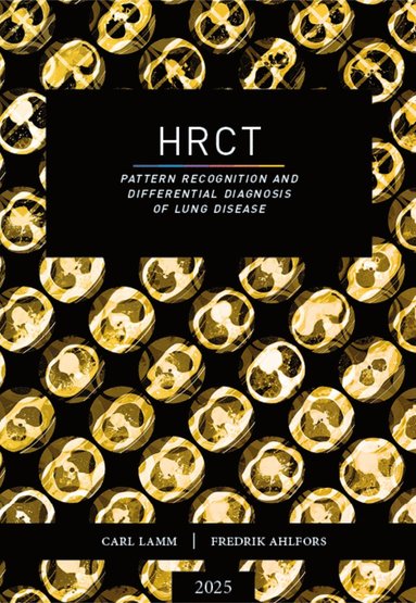 bokomslag HRCT - Pattern recognition and differential diagnosis of lung disease