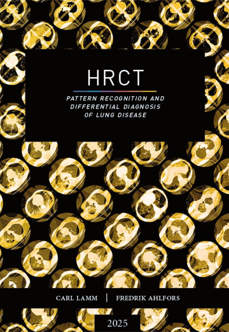 Carl Lamm, Fredrik Ahlfors - HRCT : pattern recognition and differential diagnosis of lung disease, Häftad