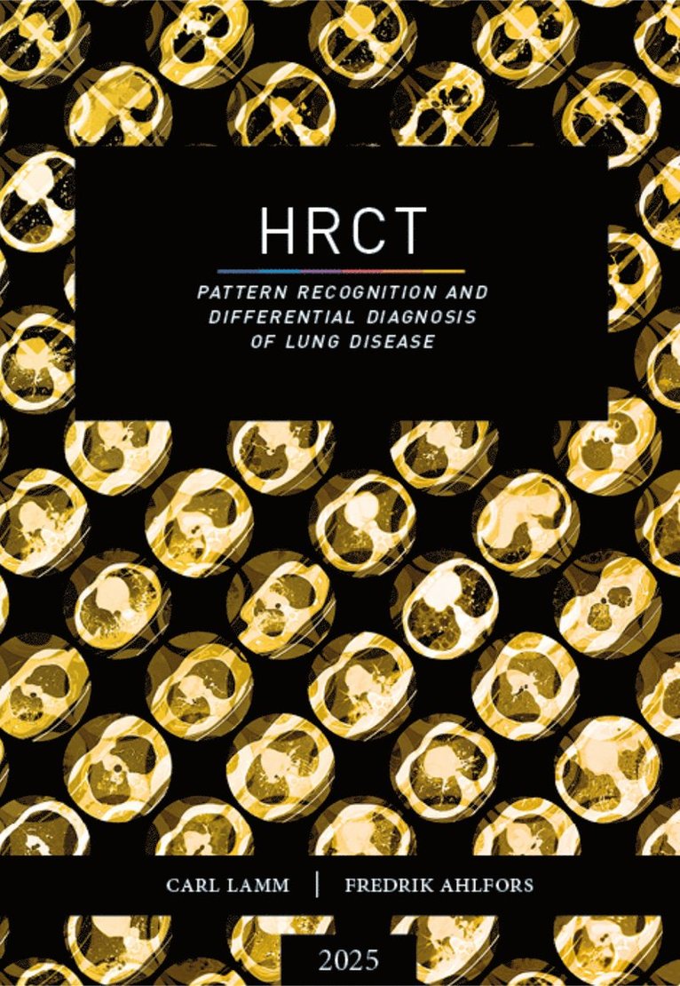 HRCT - Pattern recognition and differential diagnosis of lung disease 1