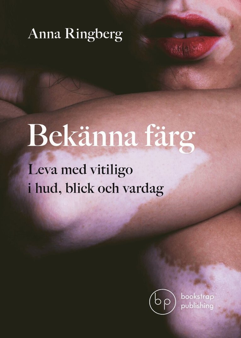 Bekänna färg : leva med vitiligo i hud, blick och vardag