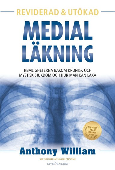 Anthony William - Medial läkning : hemligheterna bakom kronisk och mystisk sjukdom och hur man kan läka, Inbunden