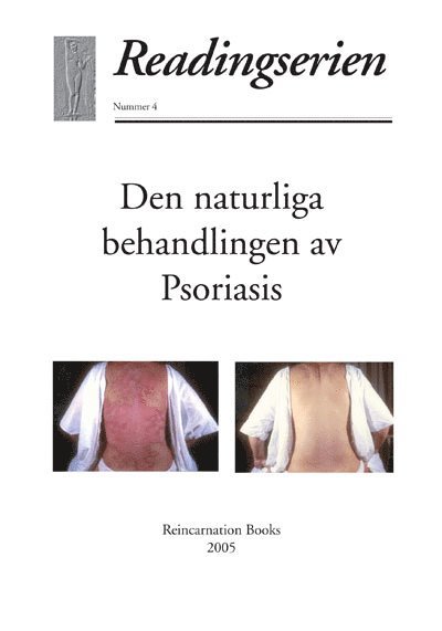Den naturliga behandlingen av psoriasis