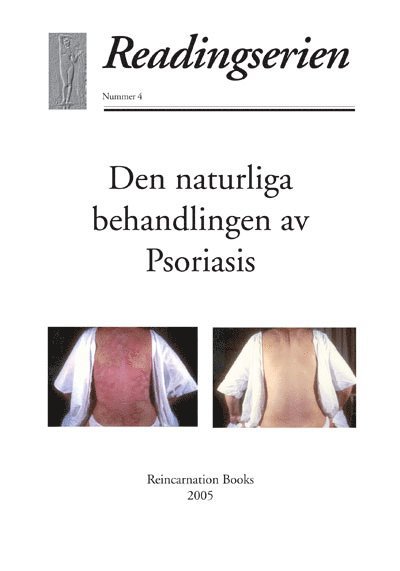 Den naturliga behandlingen av psoriasis 1