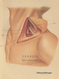 Björn Löwenhielm - Skärsår, Häftad