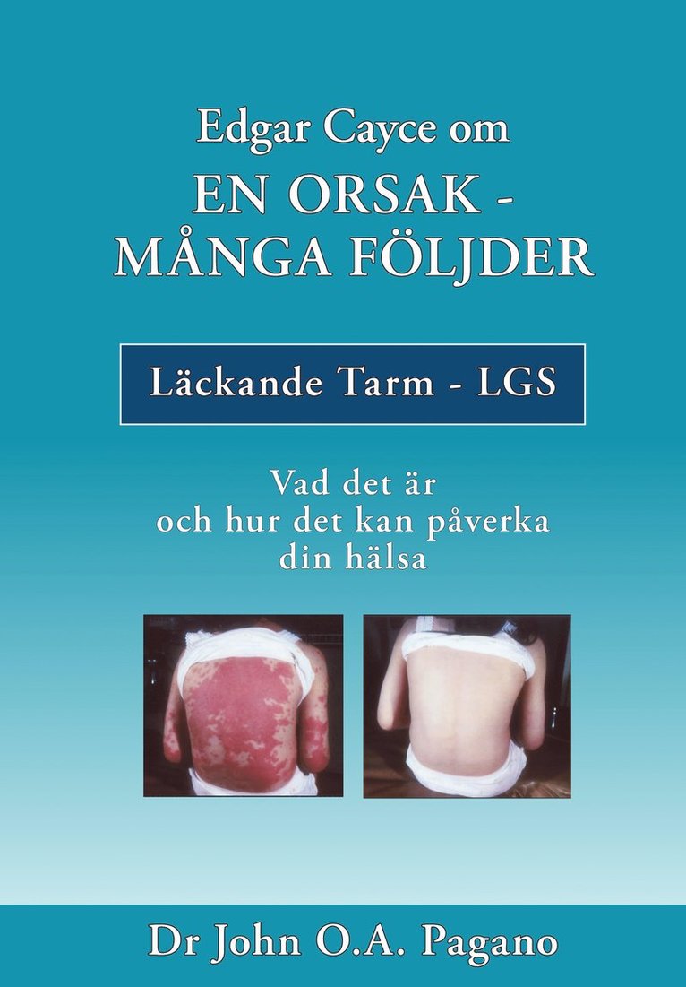 Edgar Cayce om en orsak - många följder : läckande tarm - LGS 1