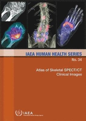 IAEA, International Atomic Energy Agency - Atlas of Skeletal SPECT/CT Clinical Images, Häftad