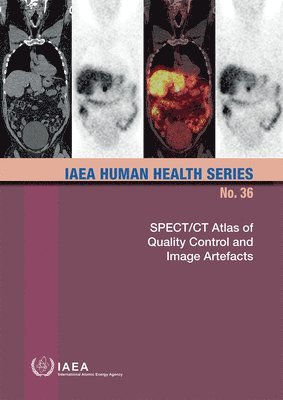 IAEA, International Atomic Energy Agency - SPECT/CT Atlas of Quality Control and Image Artefacts, Häftad