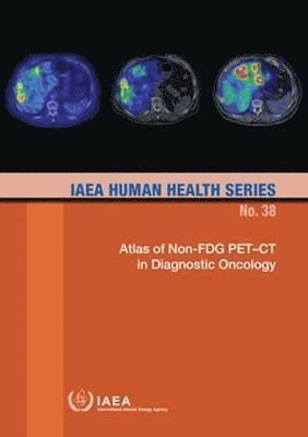 Atlas of Non-FDG PETCT in Diagnostic Oncology 1