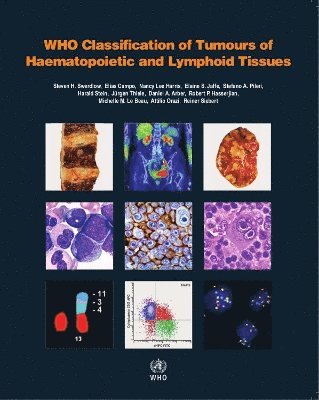 bokomslag Who Classification of Tumours of Haematopoietic and Lymphoid Tissues [Op]