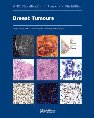 bokomslag WHO Classification of Breast Tumours