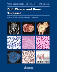 bokomslag WHO classification of tumours of soft tissue and bone tumours