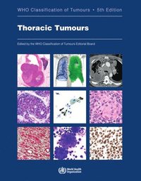 bokomslag Thoracic tumours