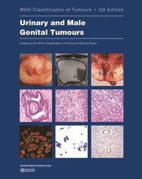 bokomslag WHO classification of tumours of the urinary system and male genital organs