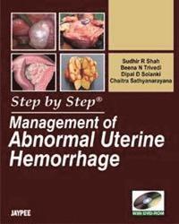 bokomslag Step by Step: Management of Abnormal Uterine Hemorrhage