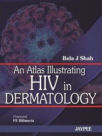bokomslag Atlas Illustrating HIV in Dermatology