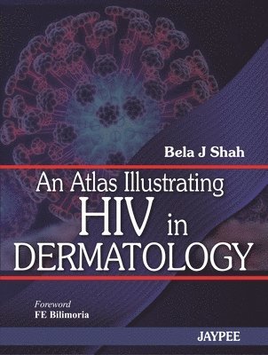 bokomslag An Atlas Illustrating HIV in Dermatology