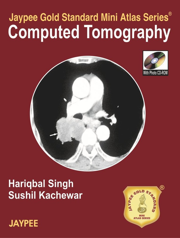 Jaypee Gold Standard Mini Atlas Series of Computed Tomography 1