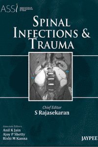 S Rajasekaran - Spinal Infections and Trauma, Inbunden