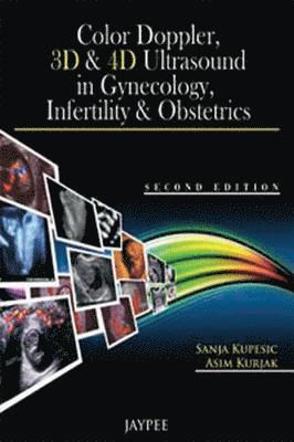 Color Doppler, 3D & 4D Ultrasound in Gynecology, Infertility & Obstetrics 1