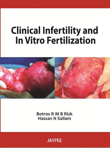 Botros R M B Rizk, Hassan N Sallam - Clinical Infertility and In Vitro Fertilization, Inbunden