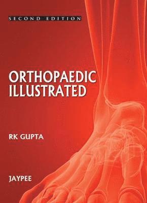 Orthopedics Illustrated 1