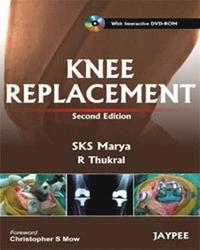 bokomslag Knee Replacement