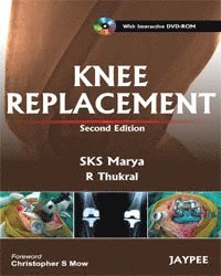 bokomslag Knee Replacement