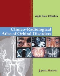 bokomslag Clinico-Radiological Atlas of Orbital Disorders