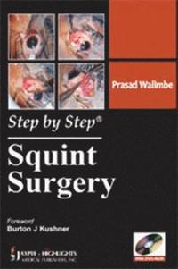 bokomslag Step by Step: Squint Surgery