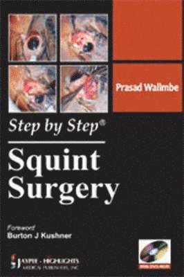 Step by Step: Squint Surgery 1