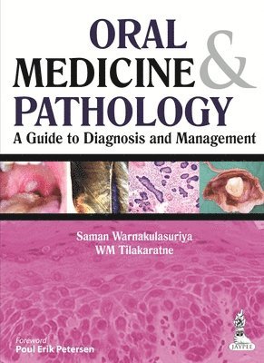Saman Warnakulasuriya, WM Tilakaratna - Oral Medicine & Pathology:  A Guide to Diagnosis and Management, Häftad
