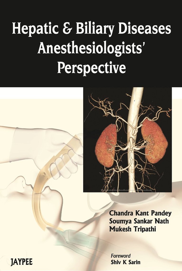 Chandra Kant Pandey, Soumya Sankar Nath, Mukesh Tripathi - Hepatic and Biliary Diseases: Anesthesiologists Perspective, Häftad