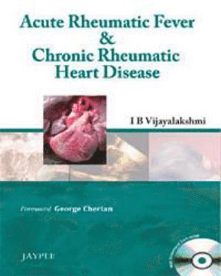 Ib Vijayalakshmi - Acute Rheumatic Fever & Chronic Rheumatic Heart Disease, Häftad