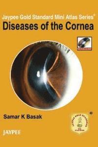 bokomslag Jaypee Gold Standard Mini Atlas Series: Diseases of the Cornea