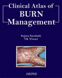 bokomslag Clinical Atlas of Burn Managment