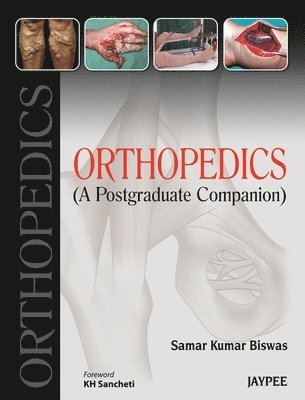 bokomslag Orthopedics: A Postgraduate Companion