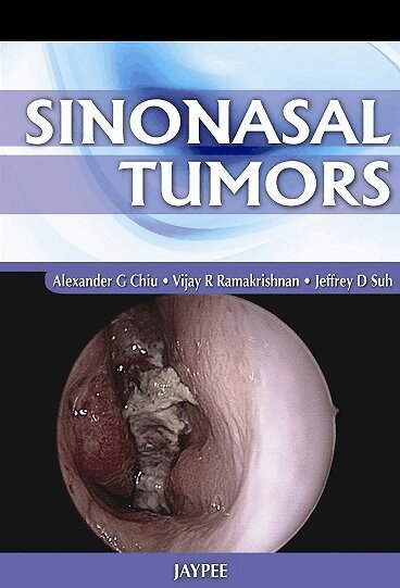 Alexander G Chiu, Vijay R Ramakrishnan, Jeffrey D Suh - Sinonasal Tumors, Inbunden