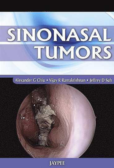 Alexander G Chiu, Vijay R Ramakrishnan, Jeffrey D Suh - Sinonasal Tumors, Inbunden