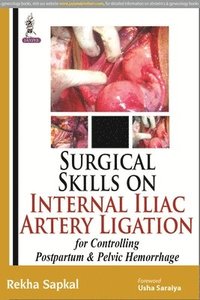 bokomslag Surgical Skills on Internal Iliac Artery Ligation for Controlling  Postpartum and Pelvic Hemorrhage