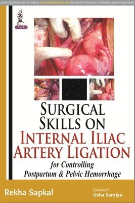 Surgical Skills on Internal Iliac Artery Ligation for Controlling  Postpartum and Pelvic Hemorrhage 1