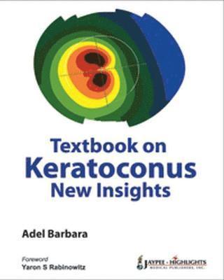 bokomslag Textbook on Keratoconus