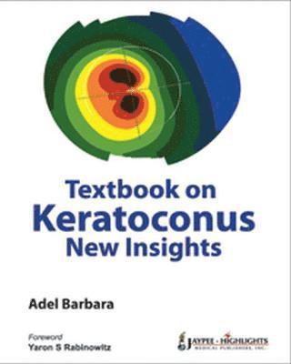Textbook on Keratoconus
