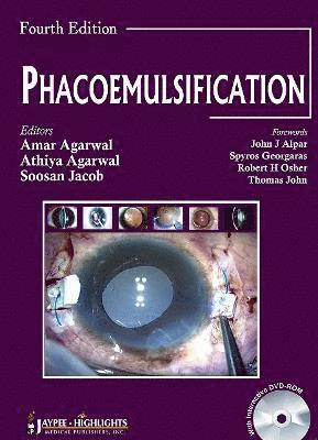 bokomslag Phacoemulsification, Fourth Edition