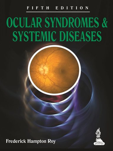 Frederick Hampton Roy - Ocular Syndromes and Systemic Diseases, Häftad