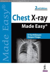 bokomslag Chest X-ray Made Easy