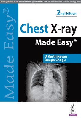 Chest X-ray Made Easy 1