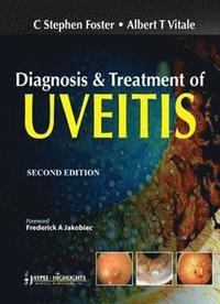 bokomslag Diagnosis & Treatment of Uveitis