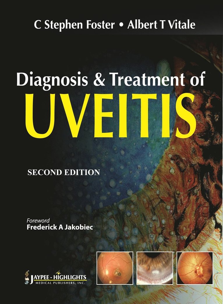 C Stephen Foster, Albert T Vitale - Diagnosis & Treatment of Uveitis, Inbunden