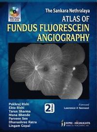 bokomslag Atlas of Fundus Fluorescein Angiography