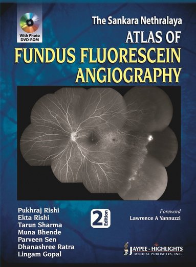 bokomslag Atlas of Fundus Fluorescein Angiography